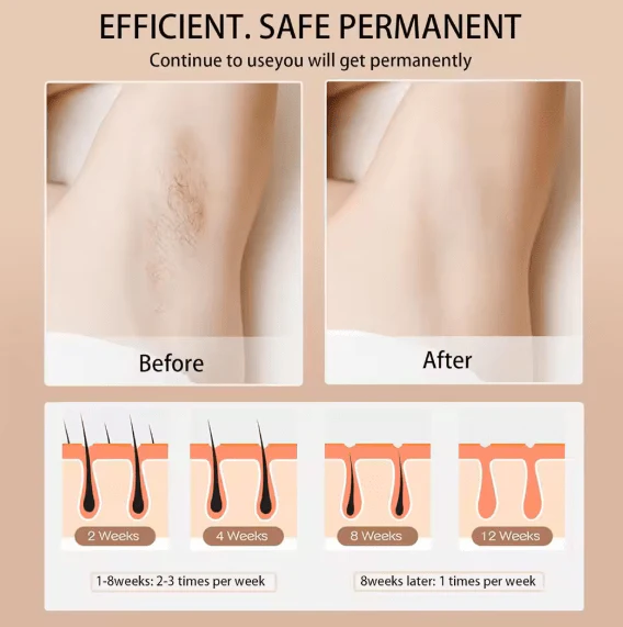 Babyverse - Digital IPL Hair Removal Device